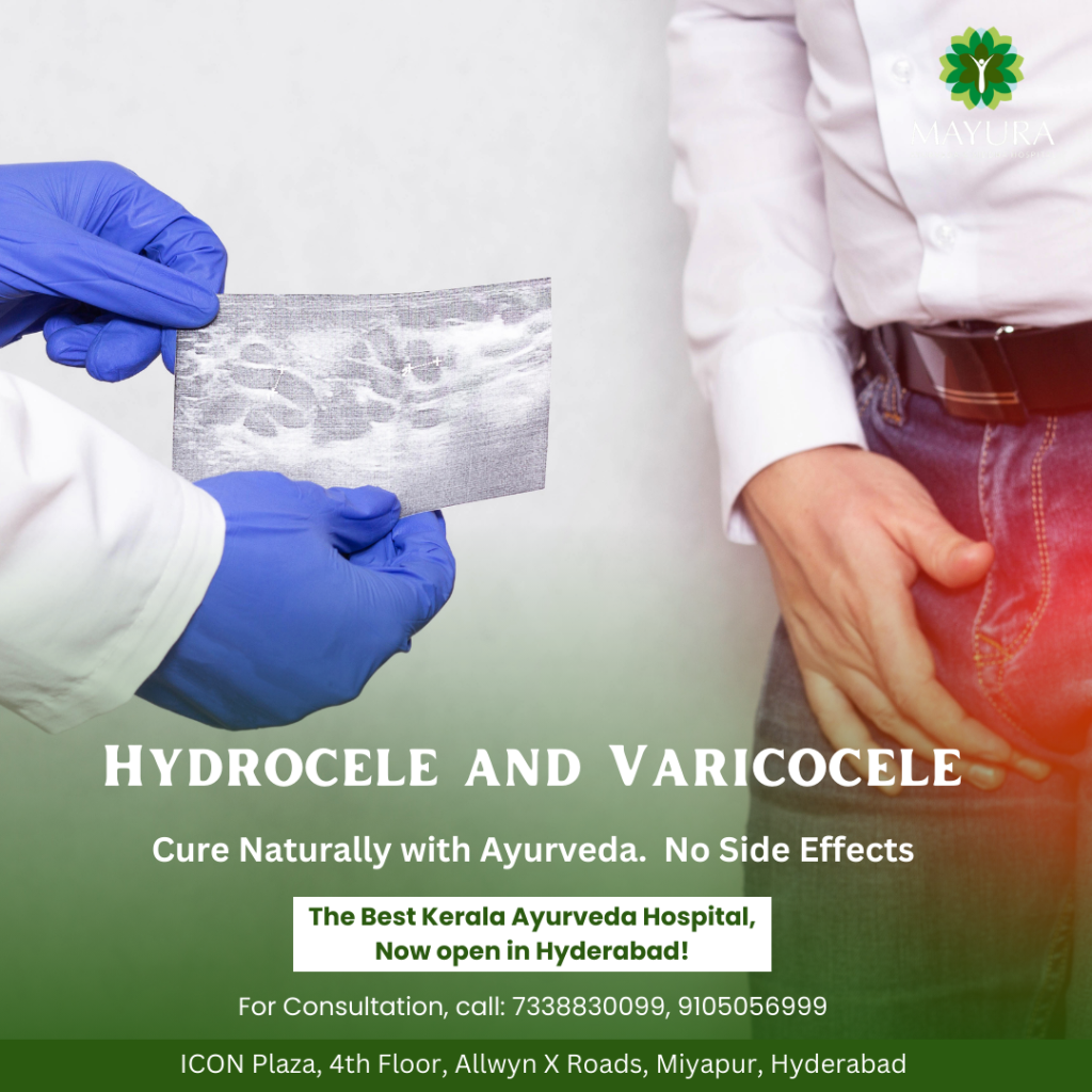 Understanding Hydrocele And Varicocele: Causes, Symptoms, And Effective ...