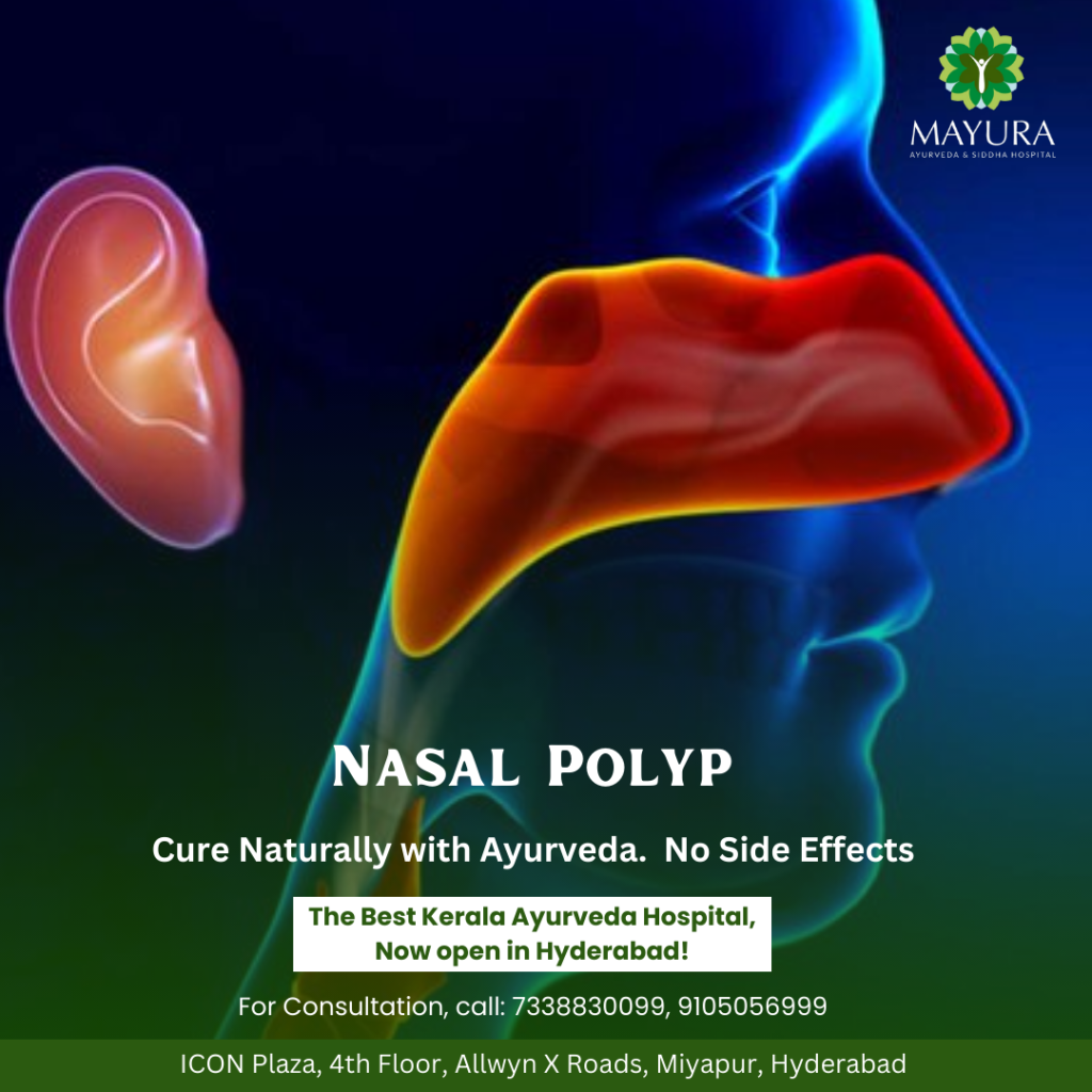 Understanding Nasal Polyps Causes, Symptoms, and Treatment Options