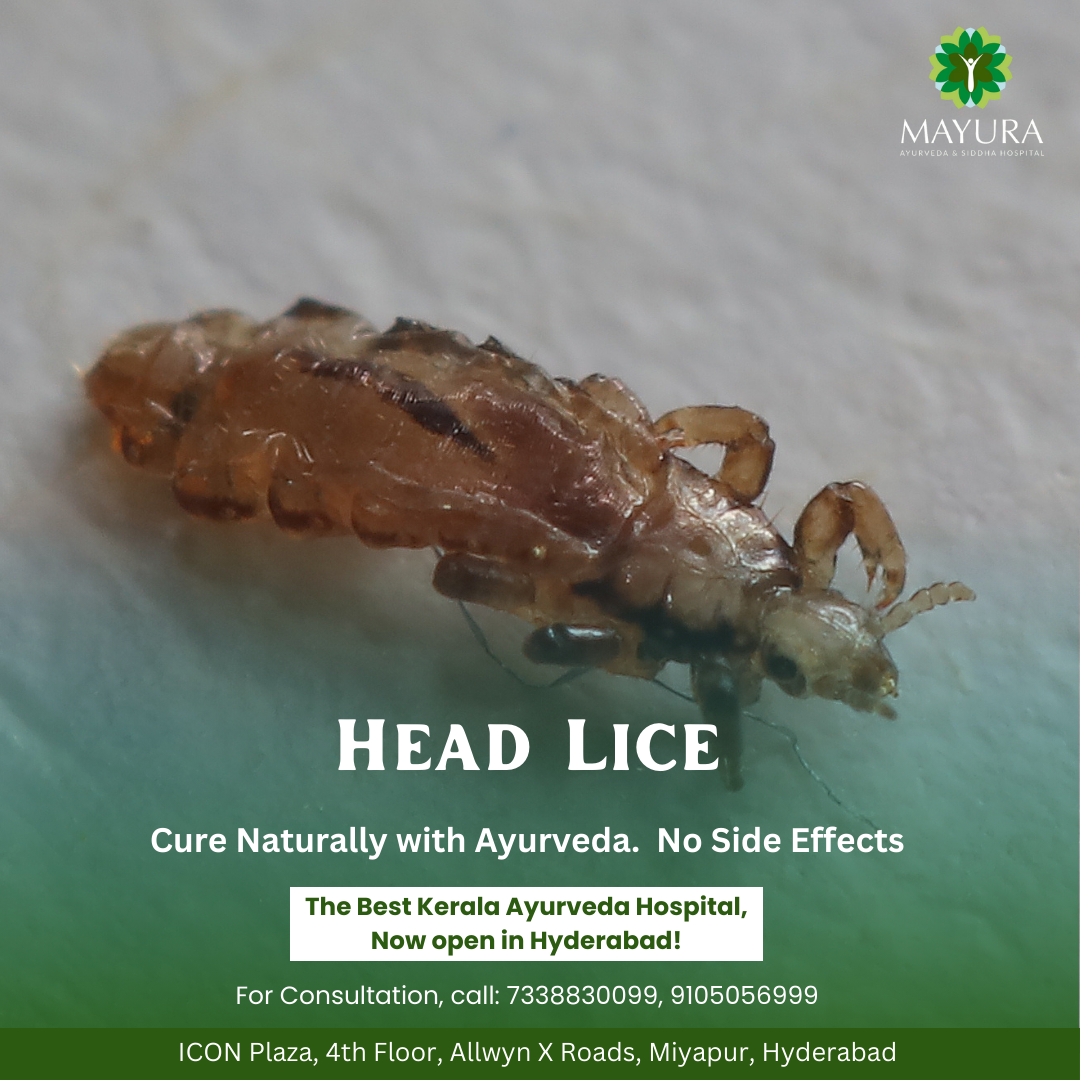 Head lice treatment