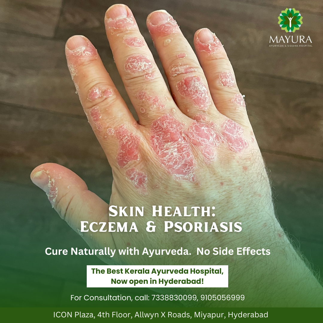 Skin Health﻿ Eczema & Psoriasis